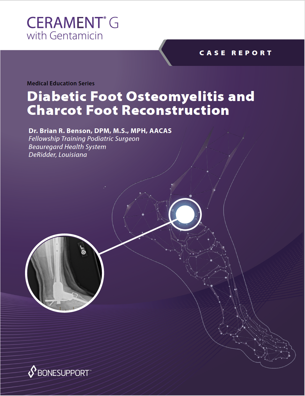 Diabetic Foot Osteomyelitis and Charcot Foot Reconstruction